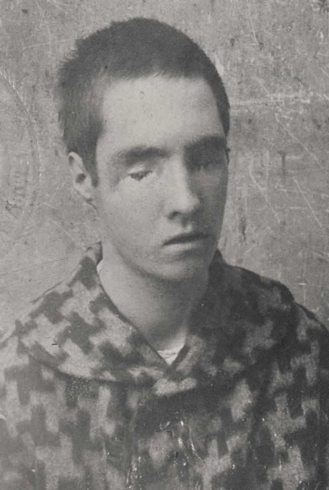 Photograph of David Melling, he has his eyes shut and you can tell that he is hurt.