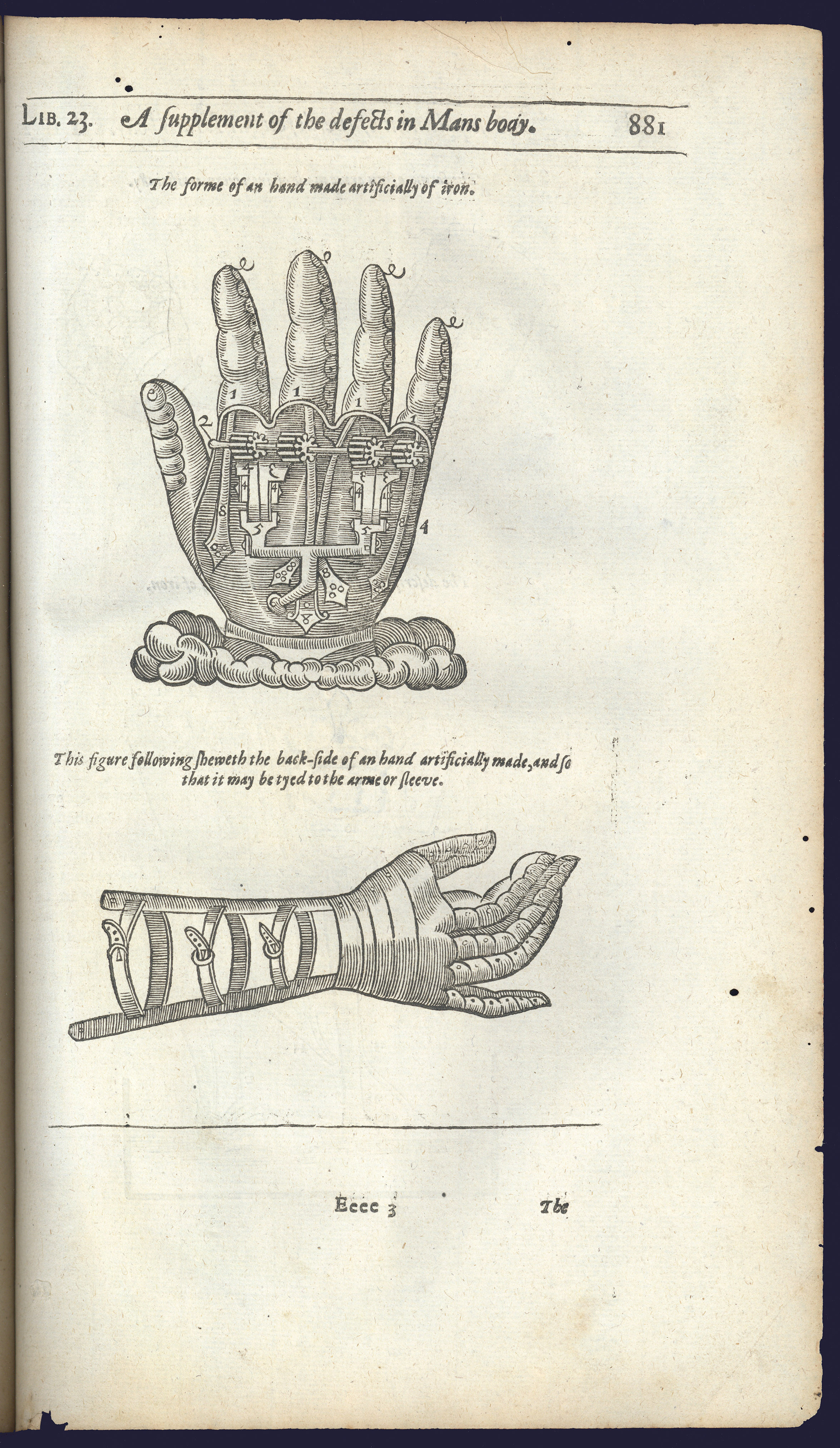 Image of a 17th century prosthetic limb